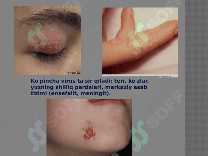 KASALLIK TARQATUVCHI VIRUSLAR 4