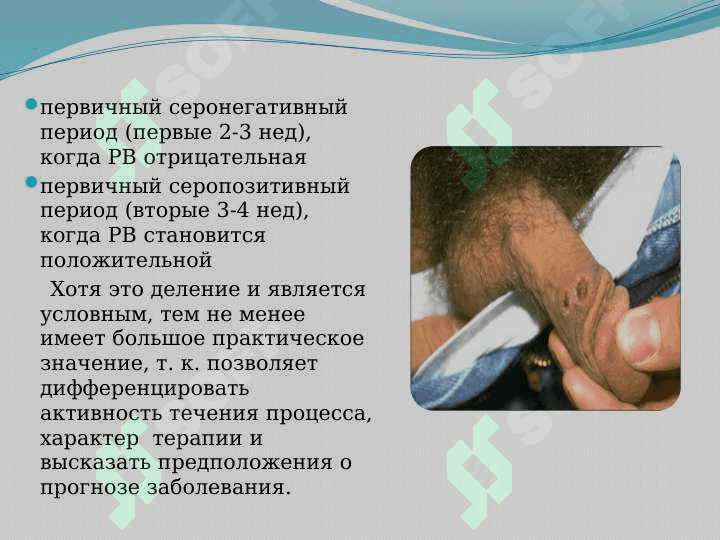 Инфекции, передаваемые половым путем 8