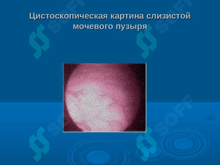 Endoskopik Urologiya. Эндоскопическая урология 8