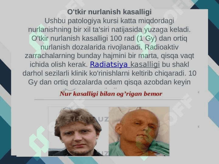 Odam nur xastaligi; xavfli va surunkali 4