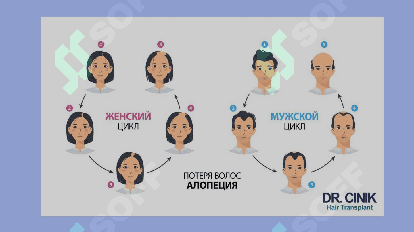 ALOPESIYANING ZAMONAVIY DAVOLASH USULLARI 7