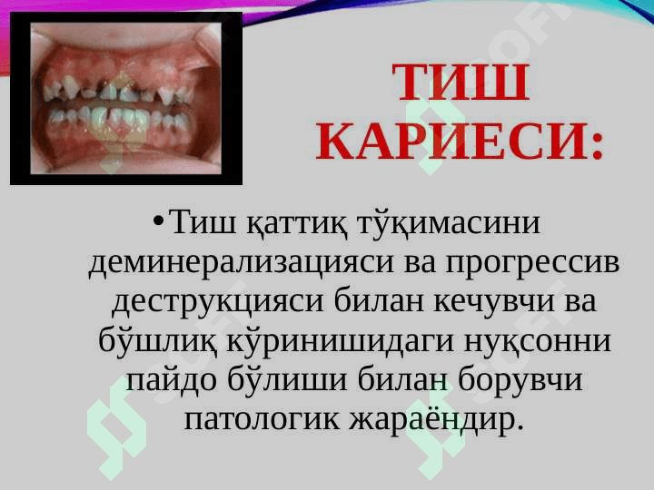 TISHKARIESNI  TASHXISLASH VA DAVOLASH 2