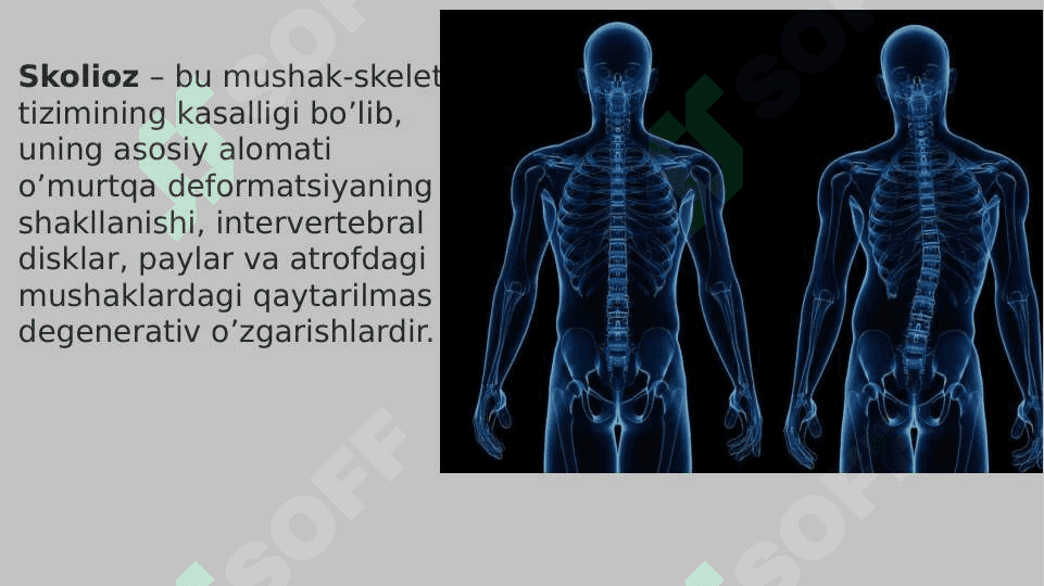 Skalioz 3
