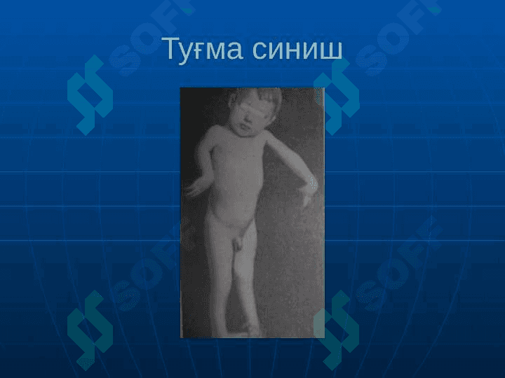 Суякларнинг синиши ва чикиши. 5