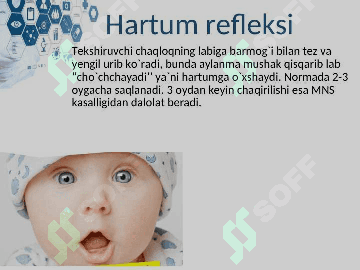 Yangi tug`ilgan chaqaloqlarning shartsiz reflekslari 6