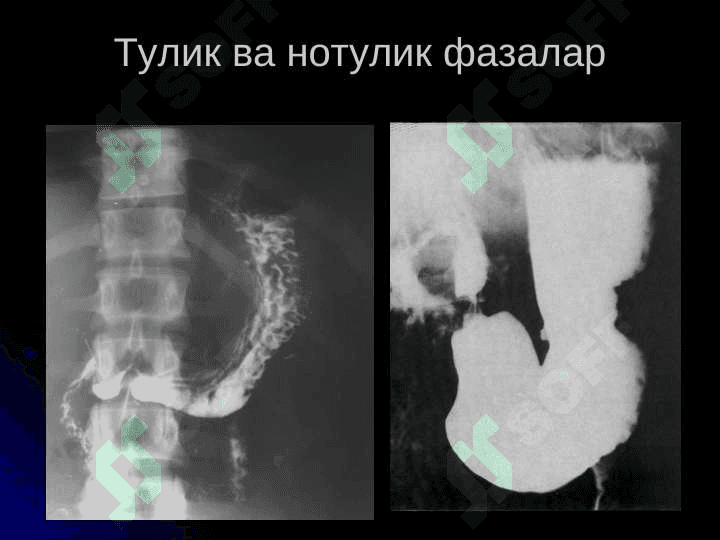 Юрак касалликларини нур ташхиси 5