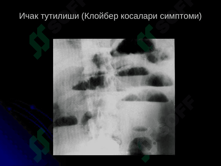 Юрак касалликларини нур ташхиси 8