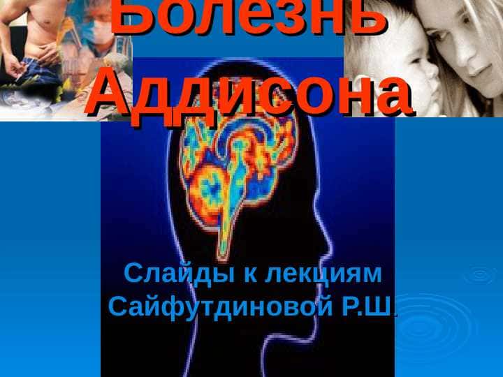 Болезнь Аддисона . Addison kasalligi