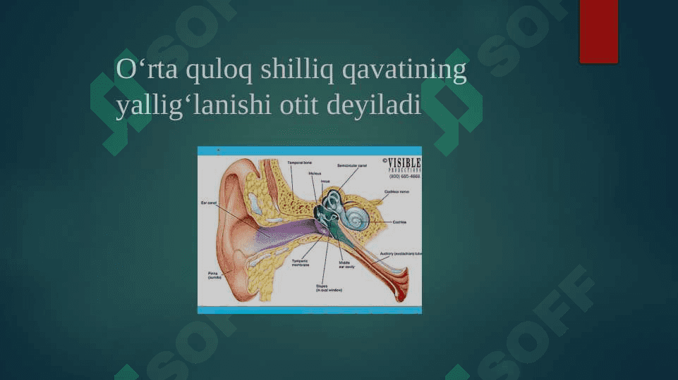 O‘rta quloqning  o‘tkir va surunkali kasalliklari 3