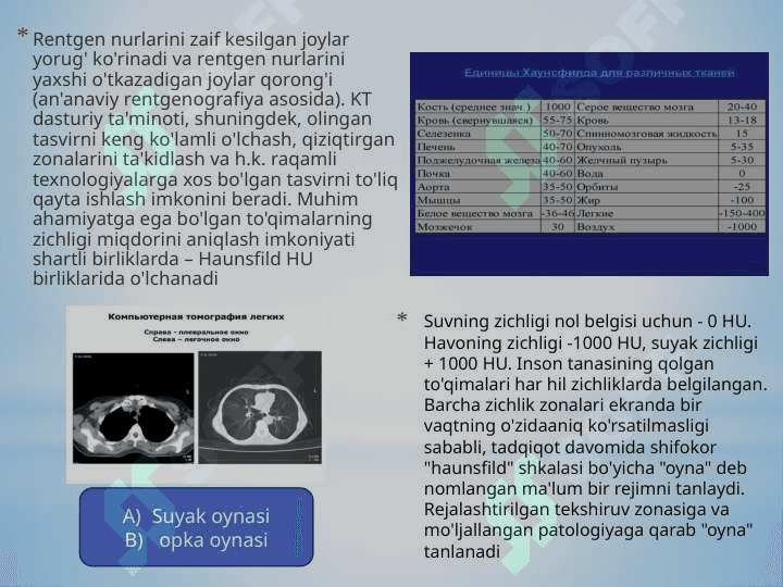 Kompyuter tomografiya 7