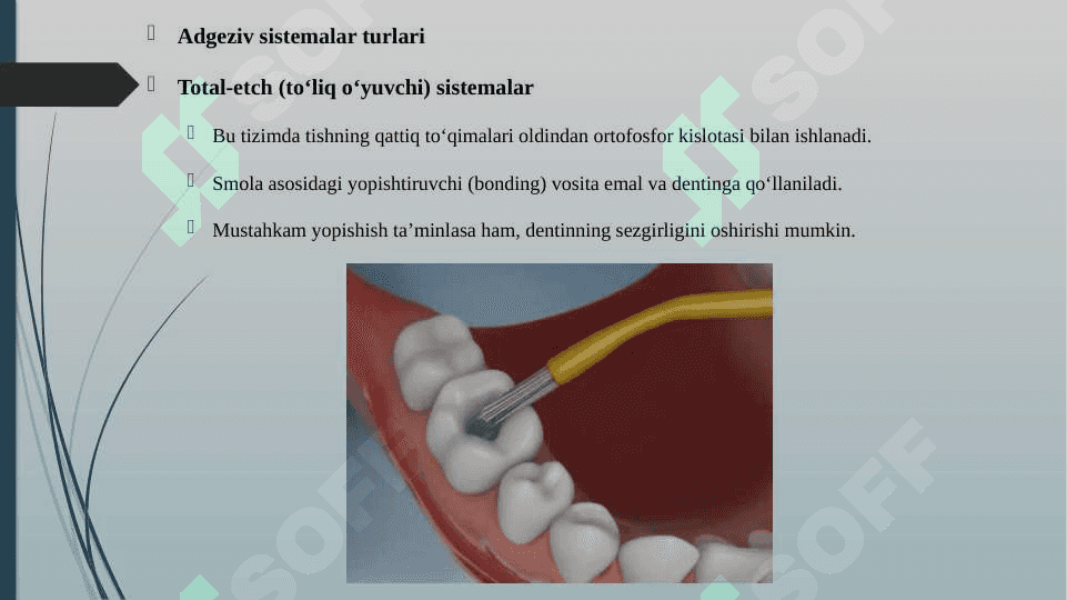 KOMPOZIT PLOMBA ASHYOLARI BILAN PLOMBALASHDA ADGEZIV SISTEMALAR 4