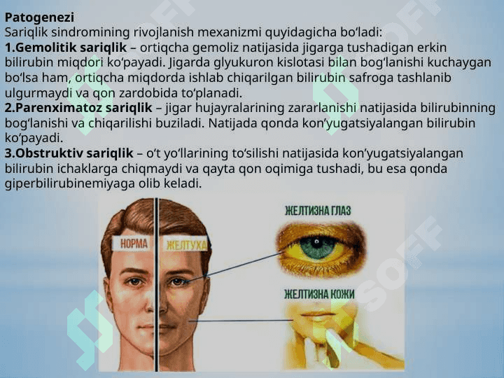 Sariqlik sindromi 5