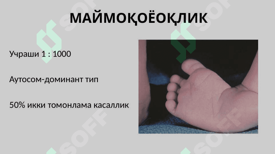 Maymoqoyoqlik . Maymoqlik . МАЙМОҚОЁҚЛИК 2