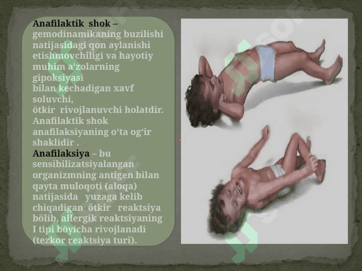 Anafilaktik  shok 2