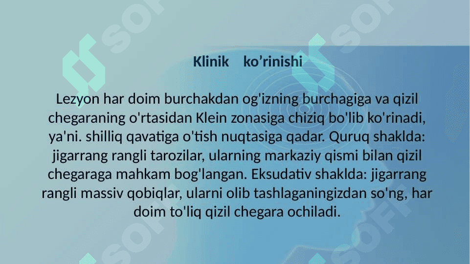 XEYLIT KASALLIGI 4