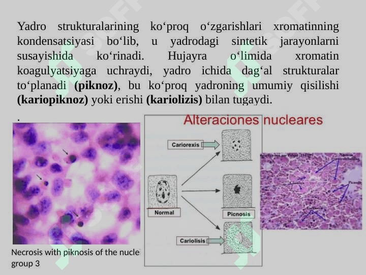 Nekroz, apoptoz-ularning tabiati va axamiyati 8