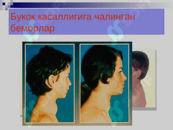 YOD YETISHMOVCHILIGI VA UNING ZARARLIOQIBATLARI 4