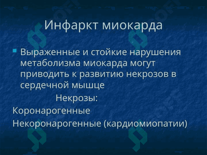 Инфаркт миокарда 2