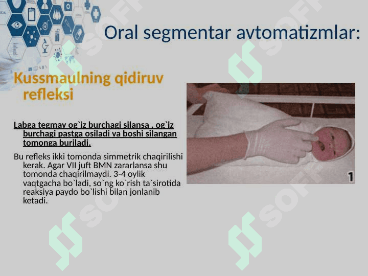 YANGI TUG`ILGAN CHAQLOQLARNING SHARTSIZ REFLEKSLARI 4