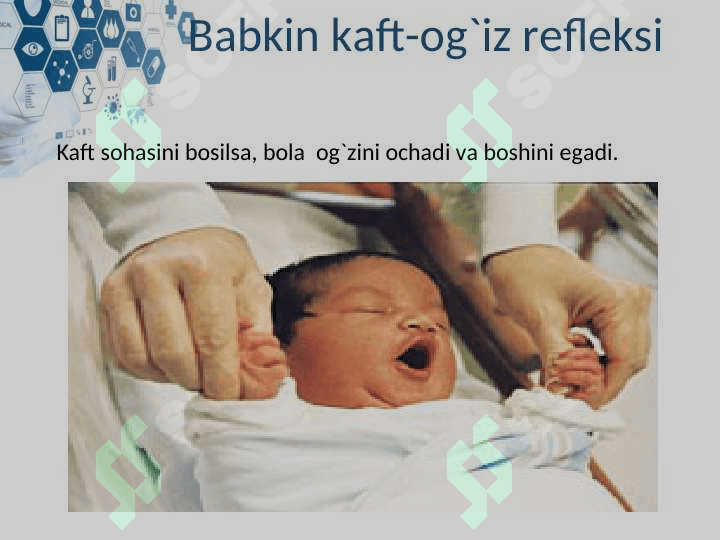 YANGI TUG`ILGAN CHAQLOQLARNING SHARTSIZ REFLEKSLARI 5