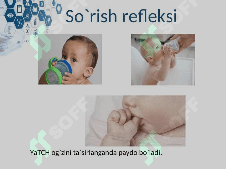 YANGI TUG`ILGAN CHAQLOQLARNING SHARTSIZ REFLEKSLARI 7