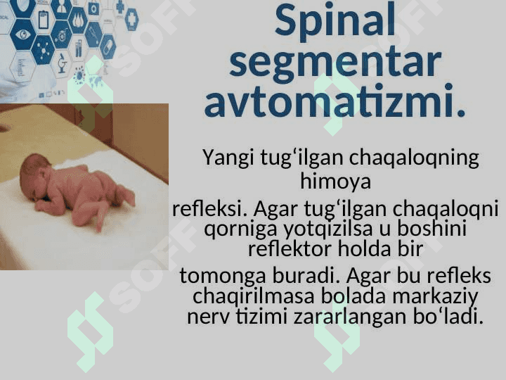 YANGI TUG`ILGAN CHAQLOQLARNING SHARTSIZ REFLEKSLARI 8