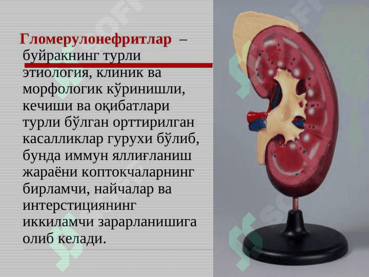 BOLALARDA  GLOMERULONEFRITLAR. 7