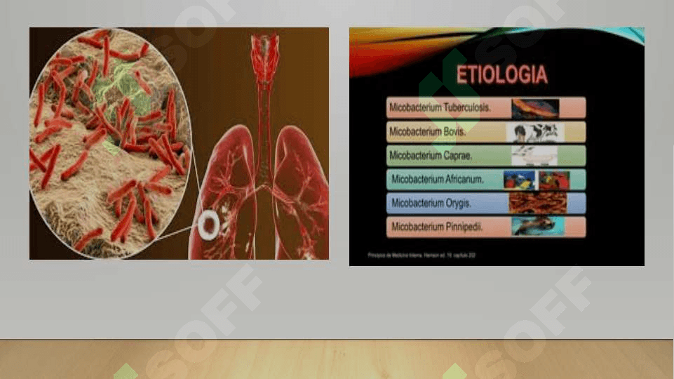 Tuberkulyoz (TB) etiologiyasi va dorilarga chidamli turlari 3