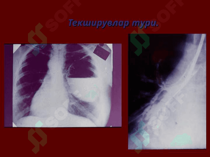 Хирургик операциялар 4