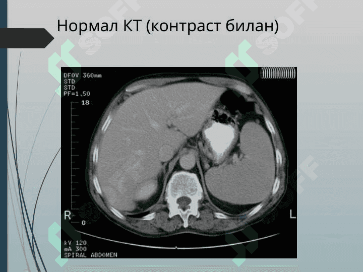 JIGAR KASALLIKLARI NUR TASHXISI. JIGAR KASALLIKLARI NUR DIAGNOSTIKA 6