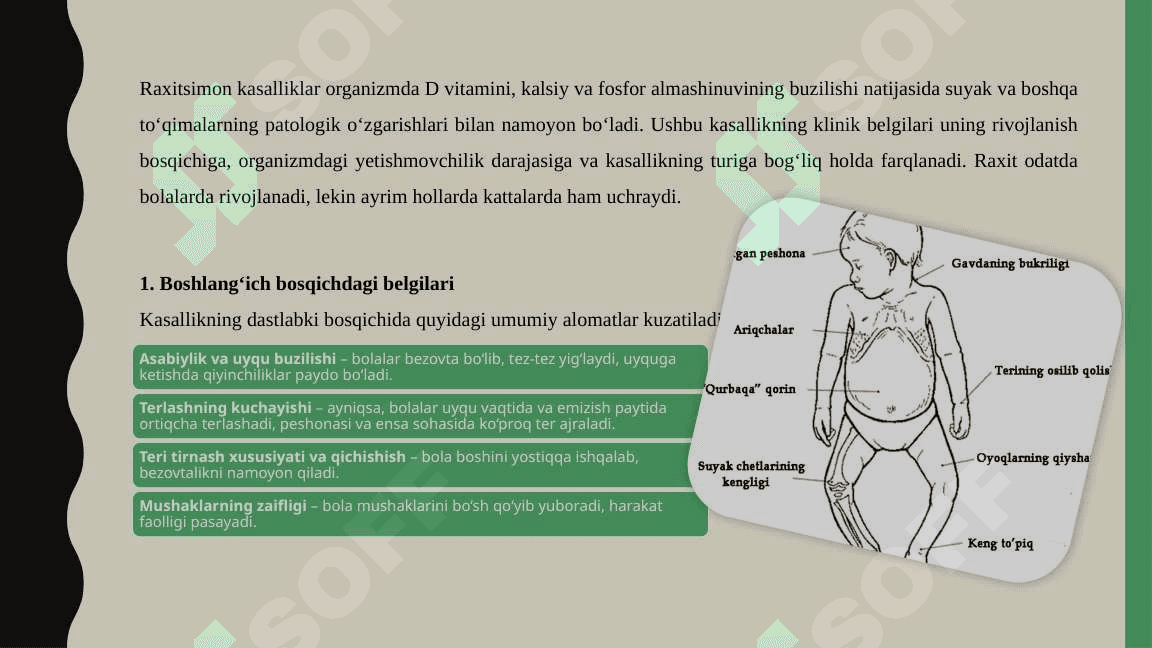 Raxitsimon kasalliklar 8