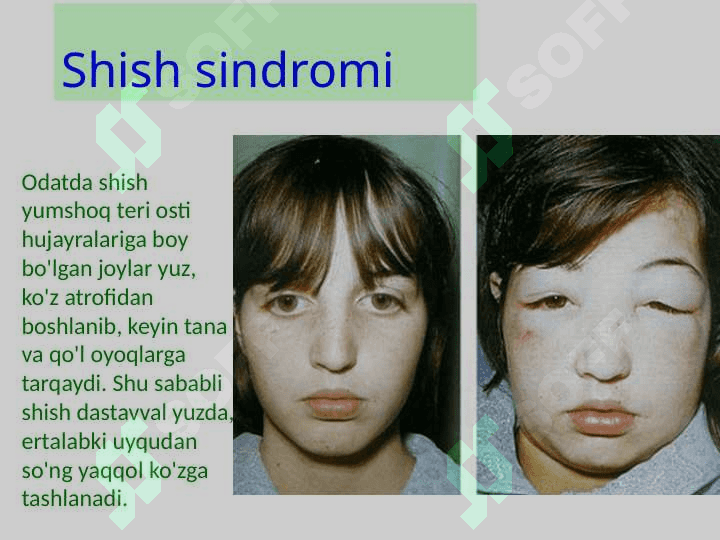 Bemorlarda shishlarni aniqlash va nazorat qilib borish 4