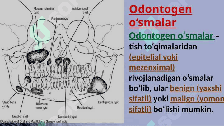 Odontogen o'smalar. Klinikasi, tashxisi, davolash 2