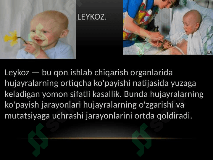 Bolalarda leykozda og'iz bo'shligi'dagi o'zgarishlar. 2