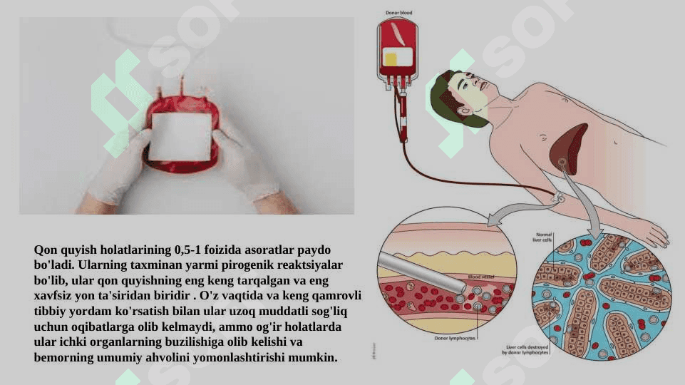 : pirogen reaksiyalar : sabablari va klinikasi 3