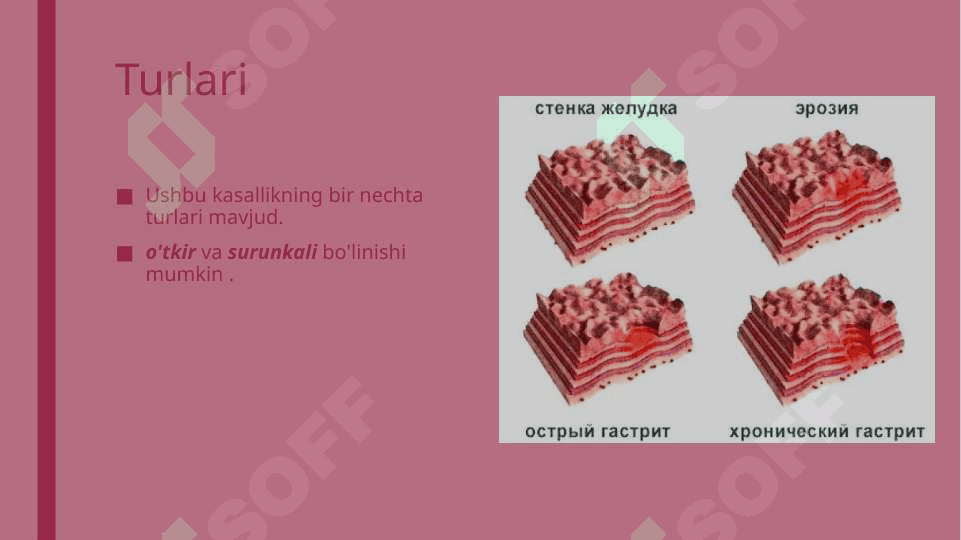 Gastrit 3