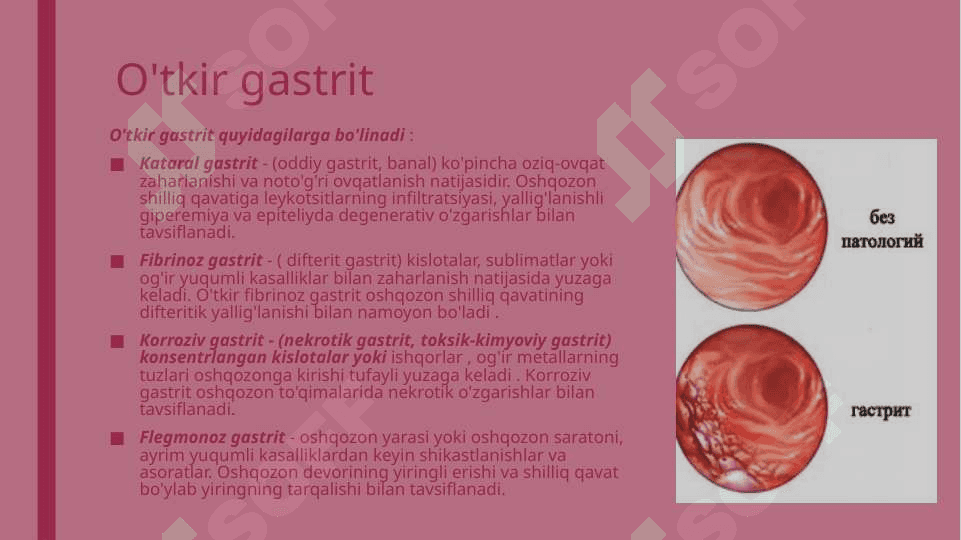 Gastrit 4