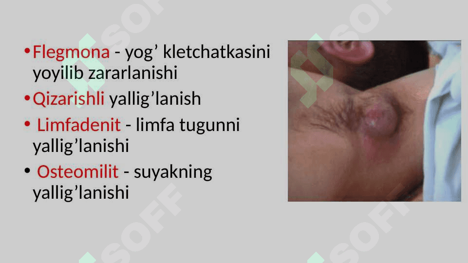 Xirurgik infeksiya 7