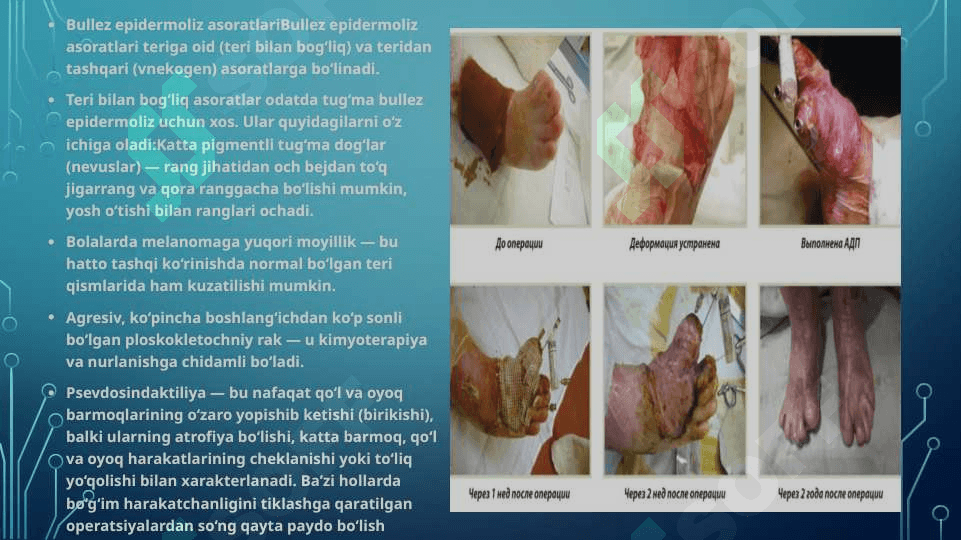 Bullyoz epidermoliz. Xeyli-Xeyli kasalligi. Chuqur mikozlar 8