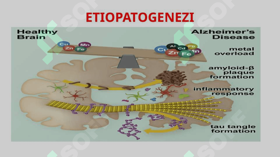 ALSGEYMER KASALLIGI 6