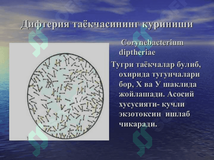 Дифтерия 5