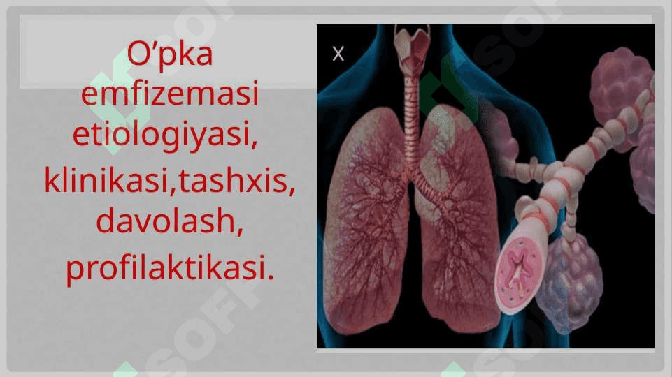 O’PKA EMFIZEMASI (2) 2