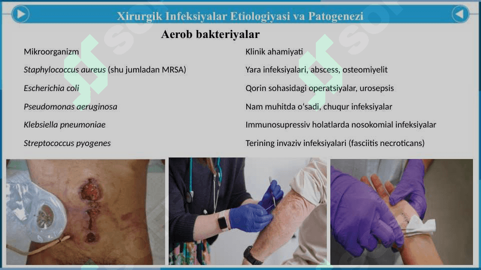 Umumiy Xirurgik Infeksiya - Умумий Хирургик Инфекция 7