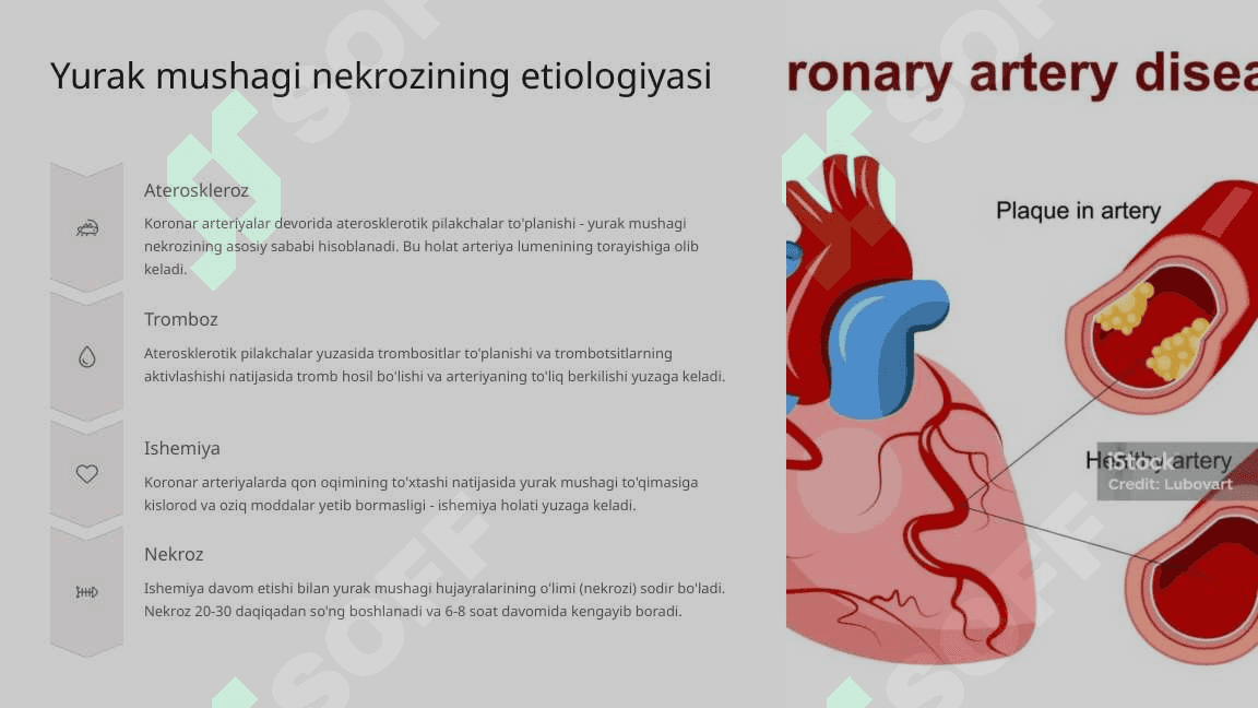 Yurak mushagi nekrozi va uning klinik belgilari 4