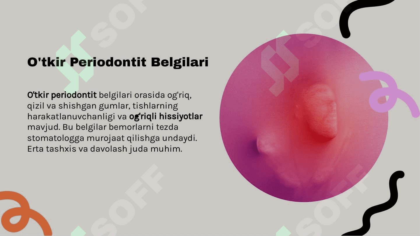 Bir va ko'p ildizli tishlarda o'tkir periodontitlarni davolash 4