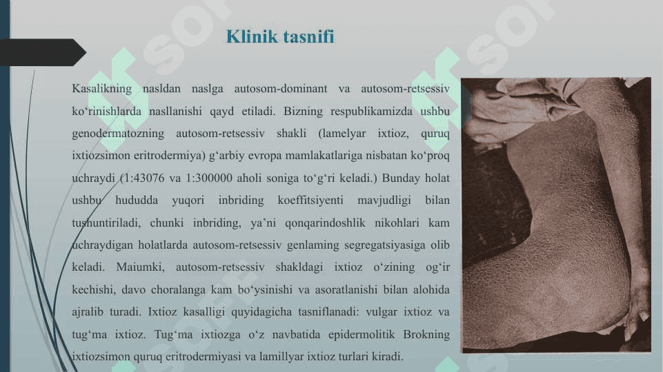 Terining irsiy kasalliklari - Терининг ирсий касалликлари 3