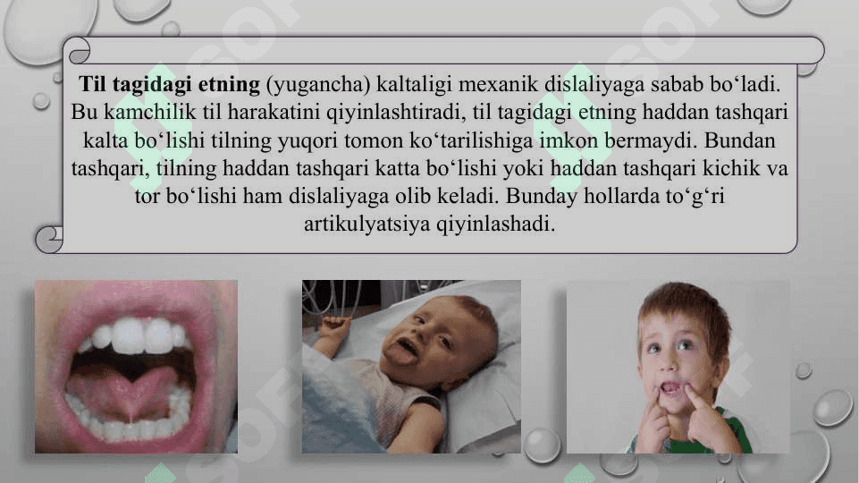 Dislaliya sabablari va shakllari, dislaliya turlari va uning namoyon bo‘lishi 5