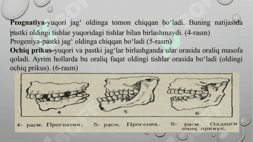 Dislaliya sabablari va shakllari, dislaliya turlari va uning namoyon bo‘lishi 7