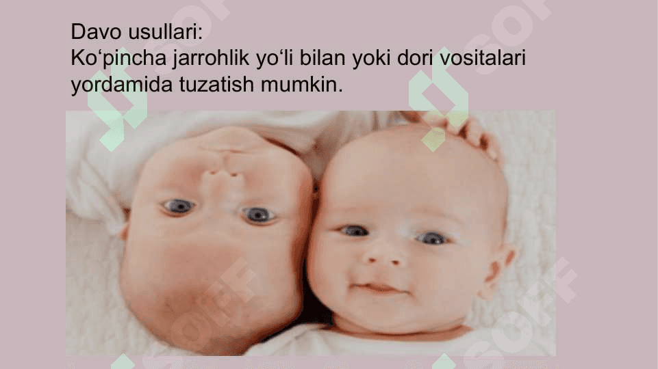 Bolalarda eshitish nuqsonining kelib chiqish sabablari va turlari 6