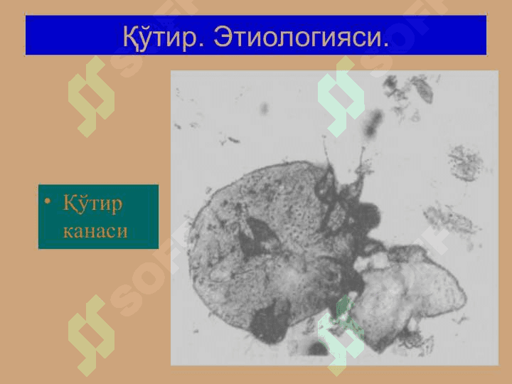 Терининг тузилиши, морфологик элементлари - Terining tuzilishi, morfologik elementlari 5